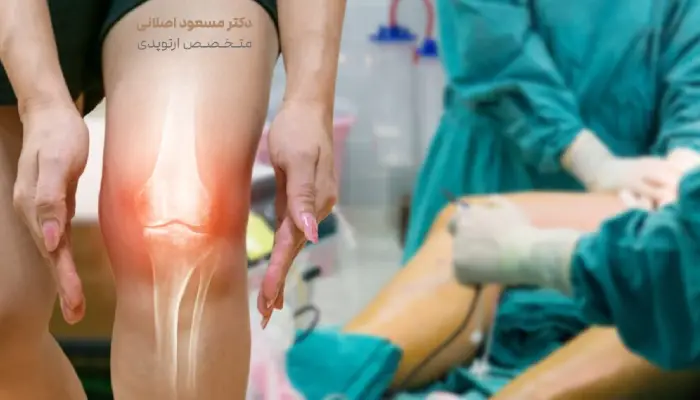 جراحی مینیسک زانو
