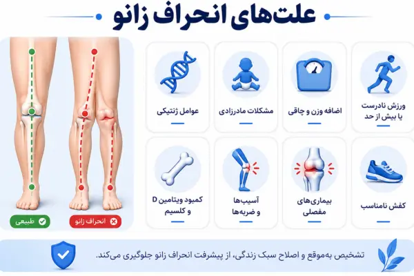 علتهای انحراف زانو
